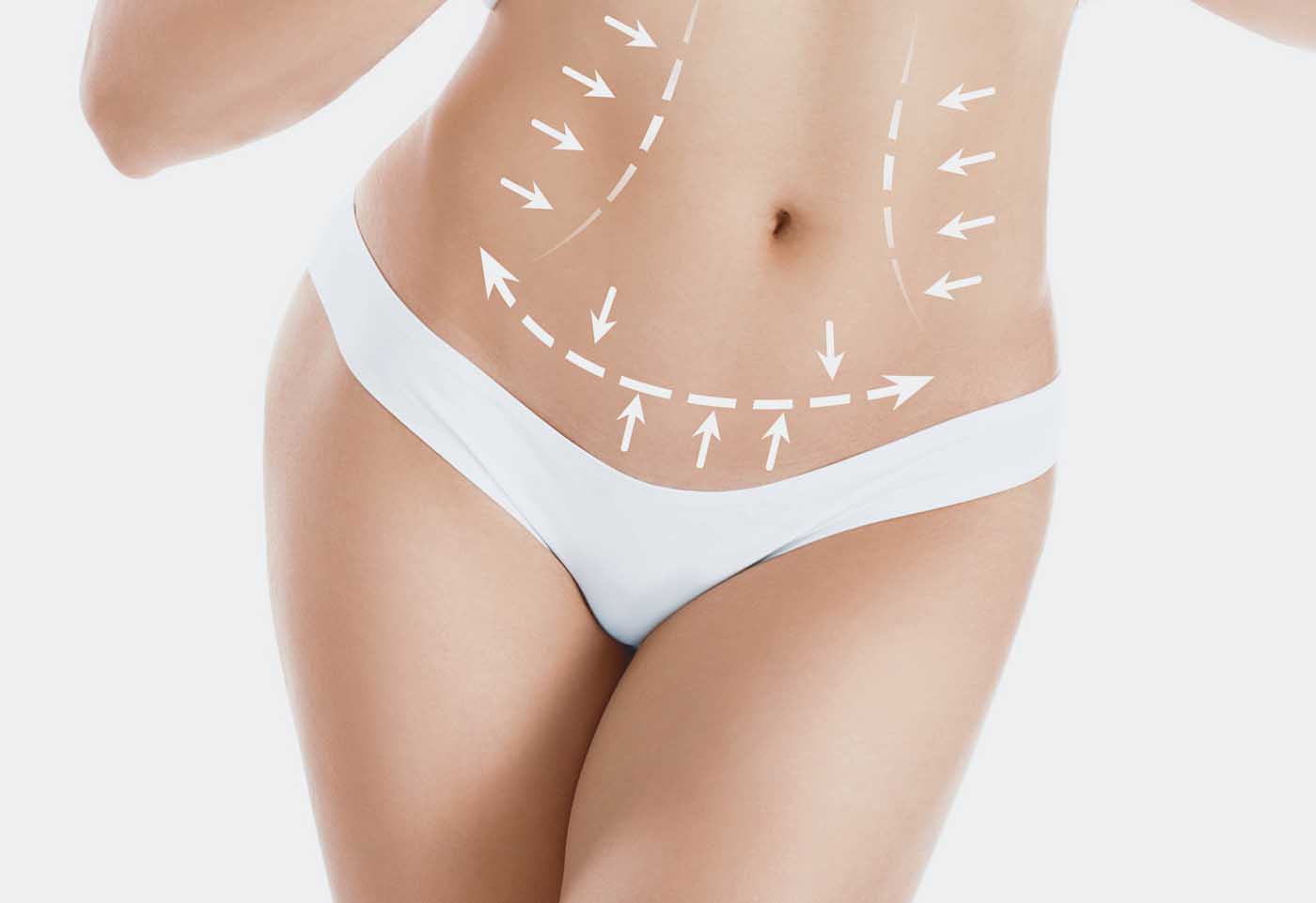 chirurgie esthetique abdomen metz