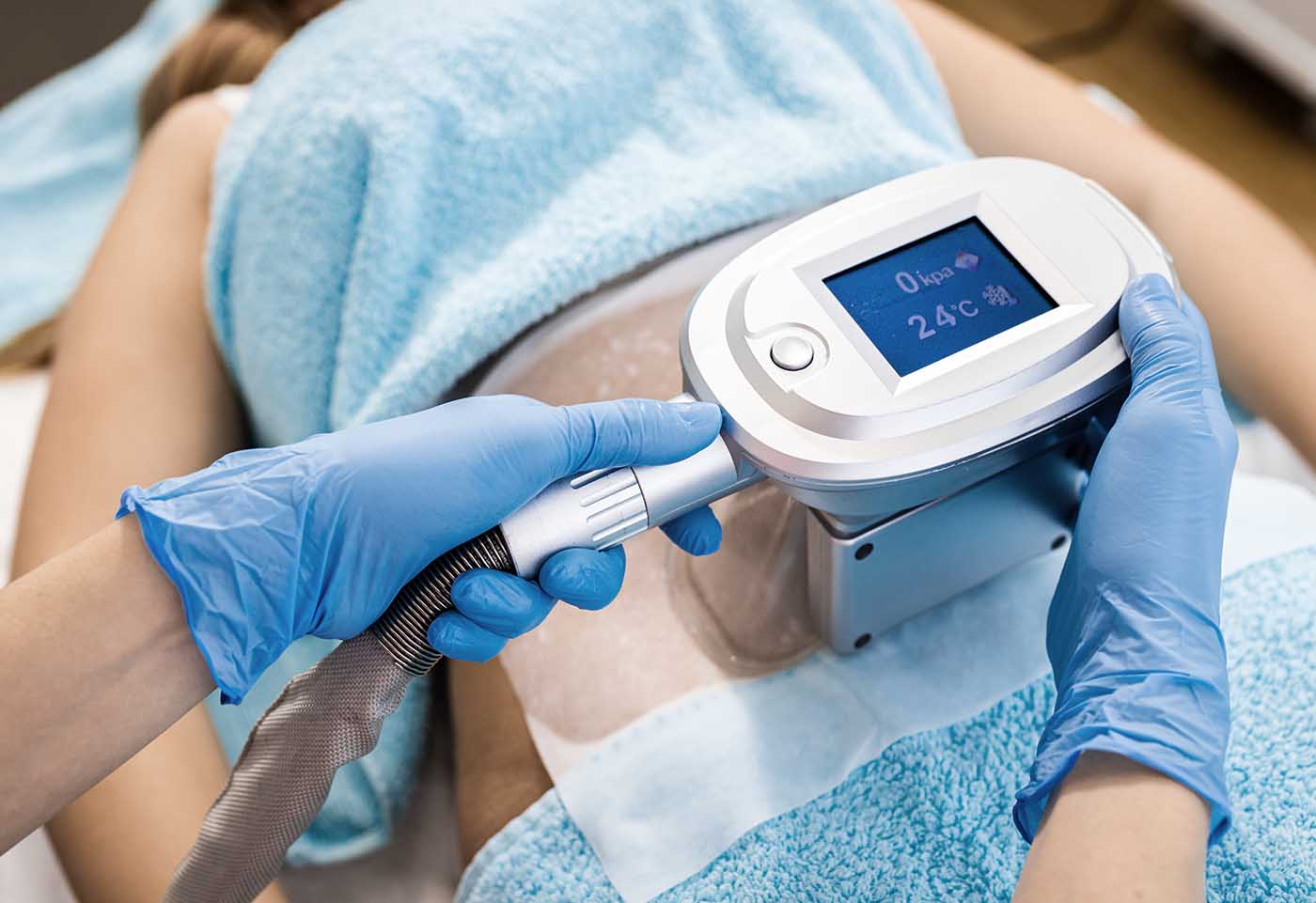 CoolSculpting cryolipolyse