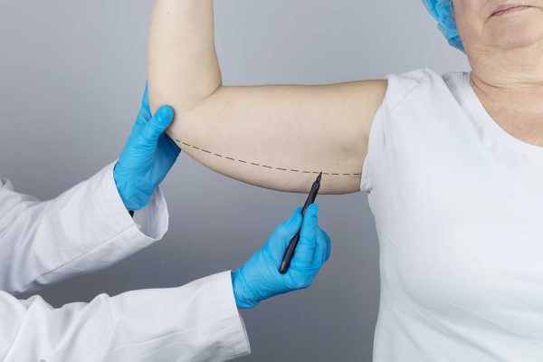 Chirurgie des bras Metz