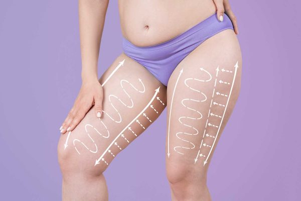 Chirurgie des cuisses Metz