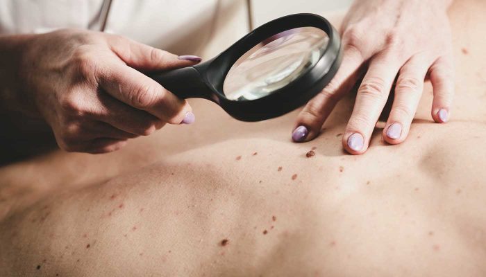 chirurgie des tumeurs metz chirurgie des tumeurs metz