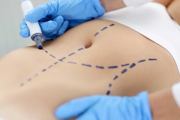 chirurgie du ventre metz